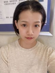体验后-成都西区医院整形美容
