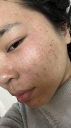 -Yestar艺星整形美容医院