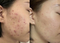 -LUNA皮相美·骨相美高级美感