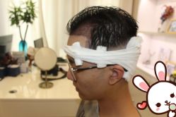 点击看大图 -大麦微针植发丨全国连锁