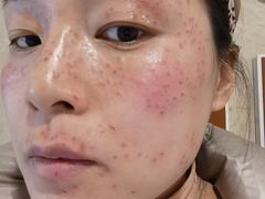 -杭州市第三人民医院