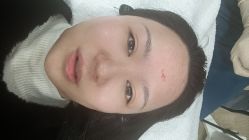 体验后-上海首尔丽格医疗美容医院