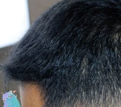 -大麦微针植发丨全国连锁