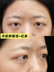 -Yestar重庆艺星医疗美容医院