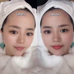 -恒妍医美·韩国定制抗衰中心