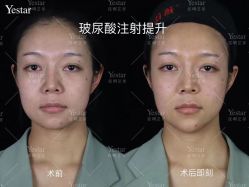 -Yestar艺星医疗美容医院