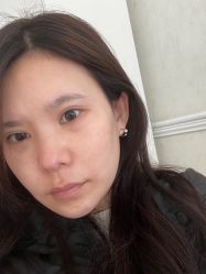 体验前-紫洁俪方（北京）医疗美容