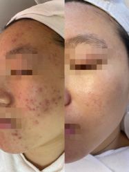-康美贞·痘肌养护管理中心