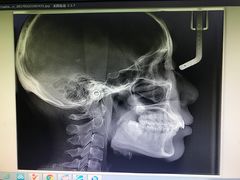 -和平卓尔口腔·矫正种植中心