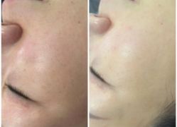 -SKIN79皮肤管理中心