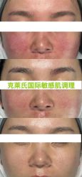 -克莱氏美肤SKIN·SPA