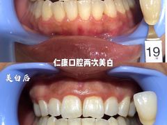 -Dr.Z dental仁康种植矫正中心