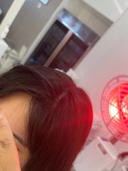 -大麦微针植发全国连锁