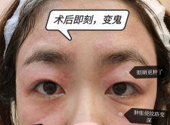 -Yestar艺星整形