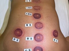 -莱仪堂艾灸经络养生馆(九亭一店)