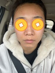 体验后-大连美天医疗美容医院