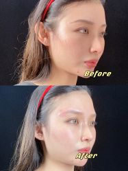 点击看大图 -广州美莱医疗美容医院