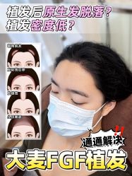 点击看大图 -大麦微针植发全国连锁
