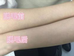 -Yestar艺星医疗美容医院