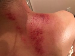 -美玫美容SPA护理中心