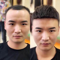 -发饰美男士增发补发假发定制店