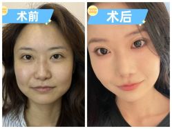 -素美医疗美容·西南眼鼻整形·修复基地