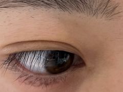 -天津大学爱尔眼科医院(天津总院)