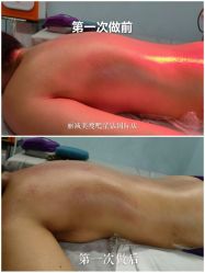 -丽减美瘦吧·减肥瘦身