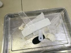 -派恩宜灰指甲鸡眼嵌甲手足癣