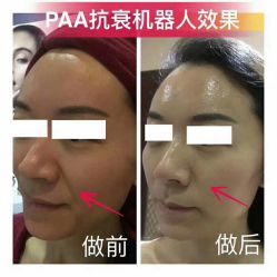 -兰派国际美容养生SPA