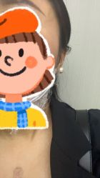 -More摩尔医美の注射线雕光电中心