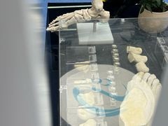 -Andrew指甲专科灰指甲·甲沟炎矫正·3D步态矫形鞋垫定制(上海法华镇路旗舰店)