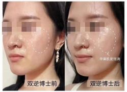 -LUNA皮相美·骨相美高级美感