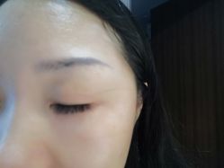 -初樱科技美学问题肌修复中心