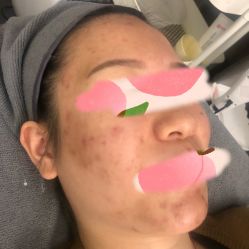-乐橙肌愈·屏障修护专研所