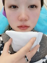 体验后-北京米扬丽格医疗美容·联合丽格鼻整形中心