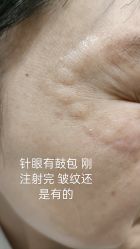 体验后-Yestar艺星医疗美容医院