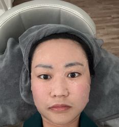 体验后-天河爱来医疗美容门诊部