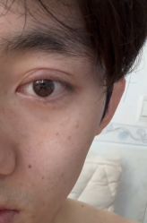 -素美医疗美容·西南眼鼻整形·修复基地