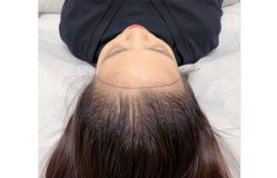 -西施无菌半永久纹绣眉眼影唇轻增发纹发际线