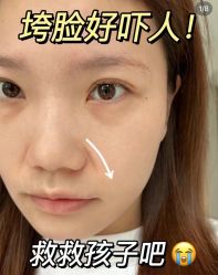 -MLP美丽派·问题肌疗愈中心