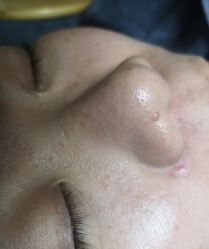 -安那般那皮肤年轻化ANAPANA