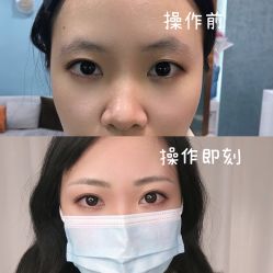 -久匠半永久纹眉