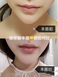 -上海漾颜医疗美容