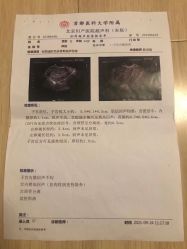 -北京妇产医院(东院)
