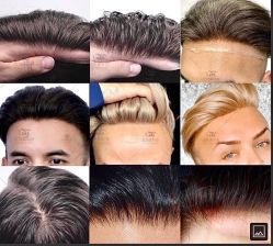 -发饰美男士增发补发假发定制店