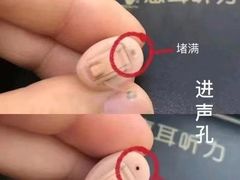 -惠耳听力助听器(霍邱新蓼大道店)