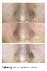 光SPA水氧+opt-光SPA科技美肤