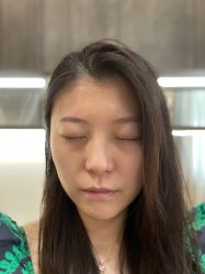 体验后-加减美医美连锁品牌
