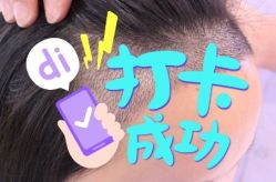 -大麦微针植发全国连锁